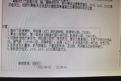 检查报告